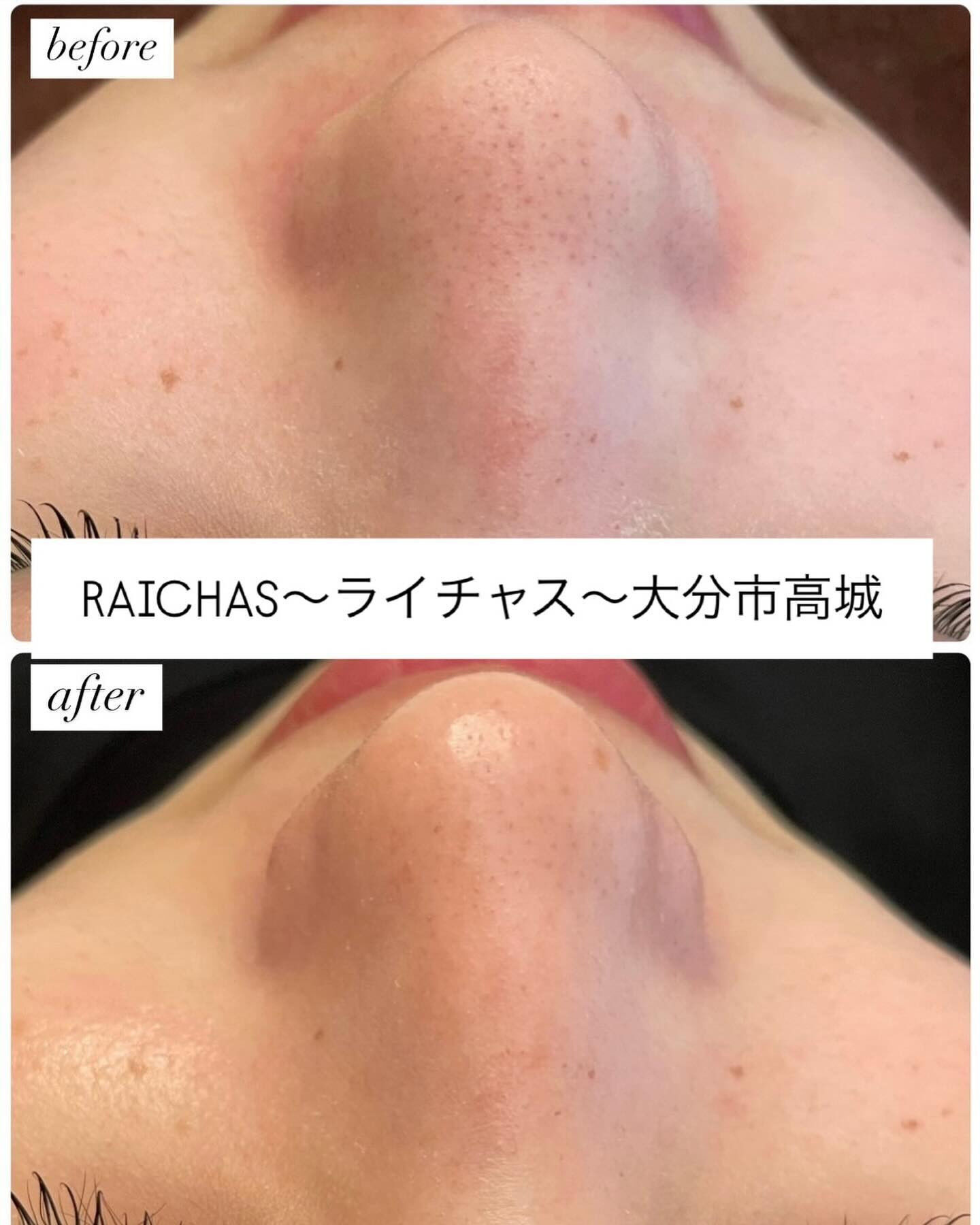 水素を発生させながら洗浄していくので